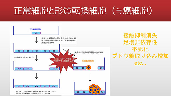 癌とはなにか？